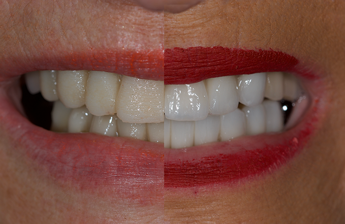 CAS-CLINIQUE dentaire COMPARAISON