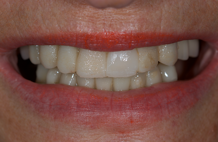 CAS-CLINIQUE dentaire AVANT