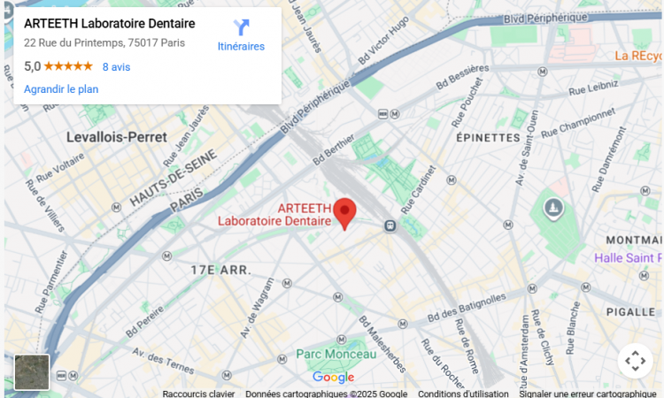 CARTE GOOGLE MAP arteeth laboratoire dentaire 22 Rue du Printemps, 75017 Paris